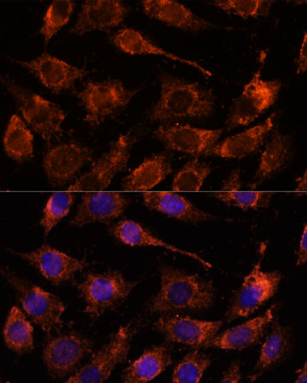 GPRASP1 Antibody in Immunocytochemistry (ICC/IF)