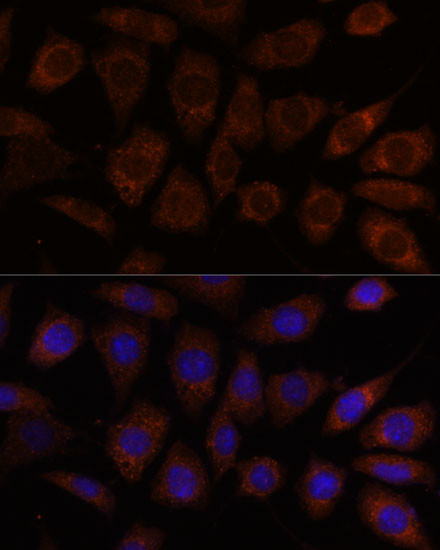 SEC24D Antibody in Immunocytochemistry (ICC/IF)