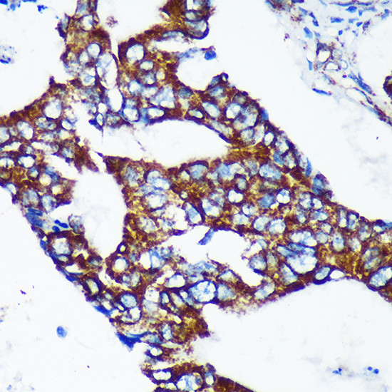 Epsin 2 Antibody in Immunohistochemistry (Paraffin) (IHC (P))