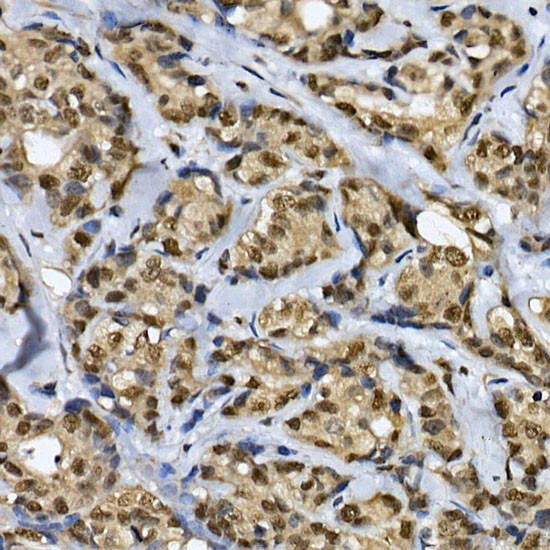 Cdc2L6 Antibody in Immunohistochemistry (Paraffin) (IHC (P))