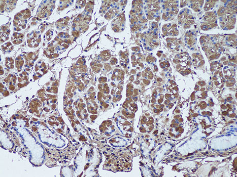 SFRP1 Antibody in Immunohistochemistry (Paraffin) (IHC (P))