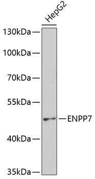 ENPP7 Antibody in Western Blot (WB)