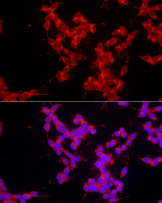 EpoR Antibody in Immunocytochemistry (ICC/IF)