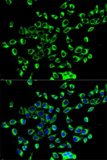 PRDX3 Antibody in Immunocytochemistry (ICC/IF)