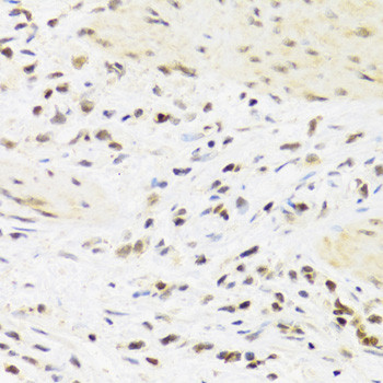 SUMO4 Antibody in Immunohistochemistry (Paraffin) (IHC (P))