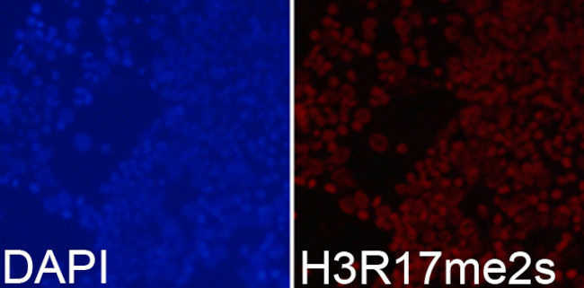 H3R17me2s Antibody in Immunocytochemistry (ICC/IF)