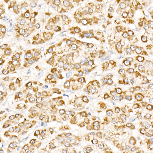NLK Antibody in Immunohistochemistry (Paraffin) (IHC (P))