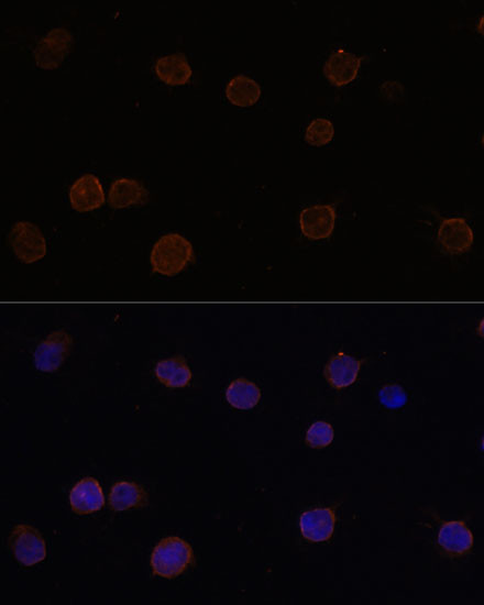 TMEM16B Antibody in Immunocytochemistry (ICC/IF)