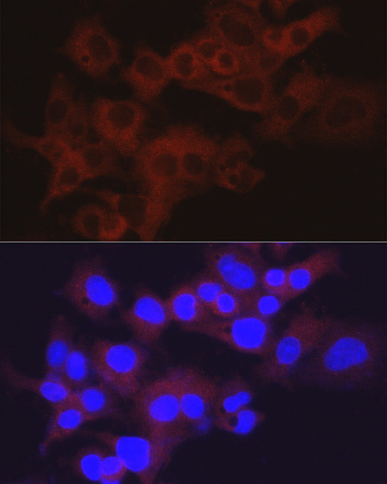 Aldolase B Antibody in Immunocytochemistry (ICC/IF)
