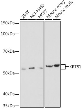 KRT81 Antibody in Western Blot (WB)