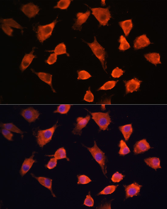 PFDN5 Antibody in Immunocytochemistry (ICC/IF)