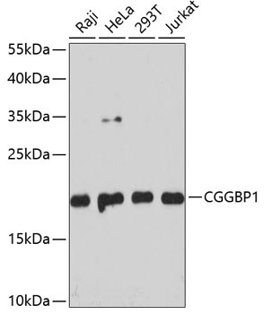 CGGBP1 Antibody in Western Blot (WB)