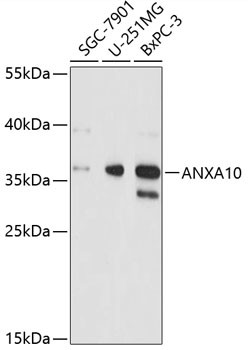 Annexin A10 Antibody in Western Blot (WB)