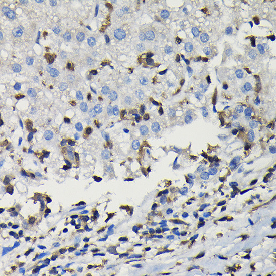 COTL1 Antibody in Immunohistochemistry (Paraffin) (IHC (P))