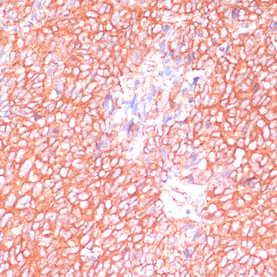 MOB4 Antibody in Immunohistochemistry (Paraffin) (IHC (P))