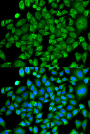 NAT13 Antibody in Immunocytochemistry (ICC/IF)