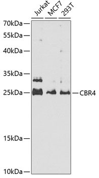 CBR4 Antibody in Western Blot (WB)