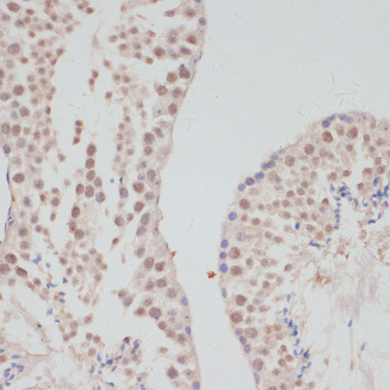 Cyclin G1 Antibody in Immunohistochemistry (Paraffin) (IHC (P))