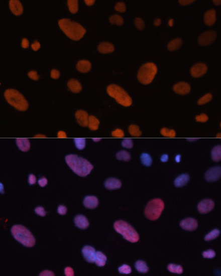 HDGF Antibody in Immunocytochemistry (ICC/IF)