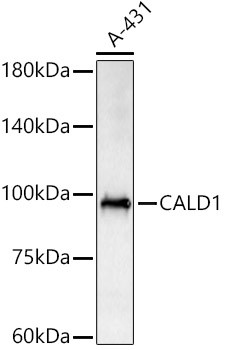 Caldesmon Antibody in Western Blot (WB)