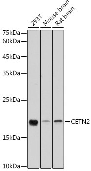 Centrin 2 Antibody in Western Blot (WB)