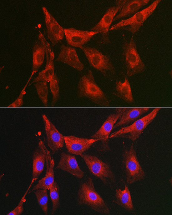 FBP1 Antibody in Immunocytochemistry (ICC/IF)