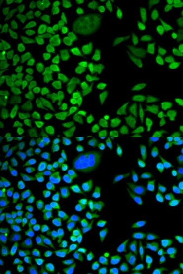 TIA-1 Antibody in Immunocytochemistry (ICC/IF)