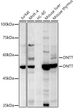 TdT Antibody in Western Blot (WB)
