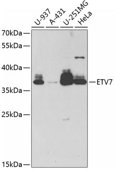 ETV7 Antibody in Western Blot (WB)