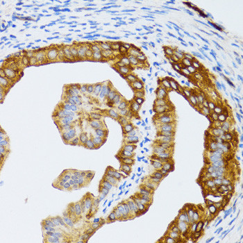 CAF1 p60 Antibody in Immunohistochemistry (Paraffin) (IHC (P))
