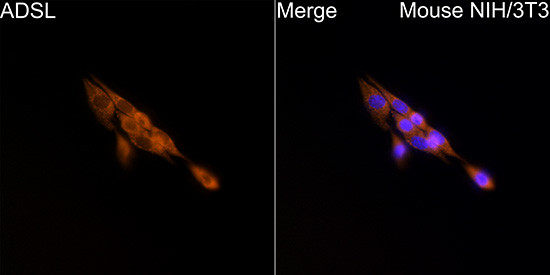 ADSL Antibody in Immunocytochemistry (ICC/IF)