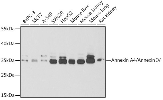 Annexin A4 Antibody in Western Blot (WB)