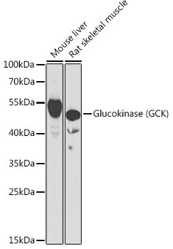 GCK Antibody in Western Blot (WB)