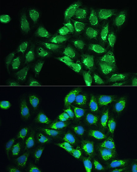 PRDX5 Antibody in Immunocytochemistry (ICC/IF)