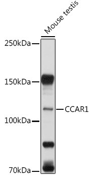 CCAR1 Antibody in Western Blot (WB)