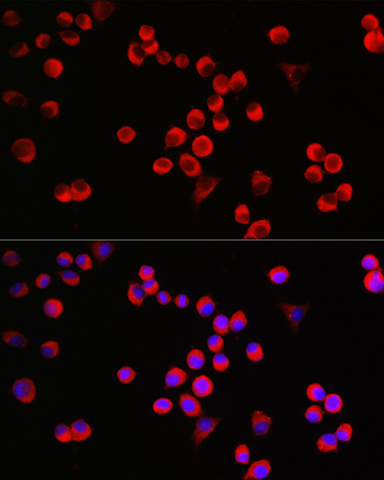 GAP43 Antibody in Immunocytochemistry (ICC/IF)