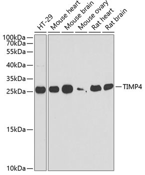 TIMP4 Antibody in Western Blot (WB)