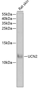 UCN2 Antibody in Western Blot (WB)