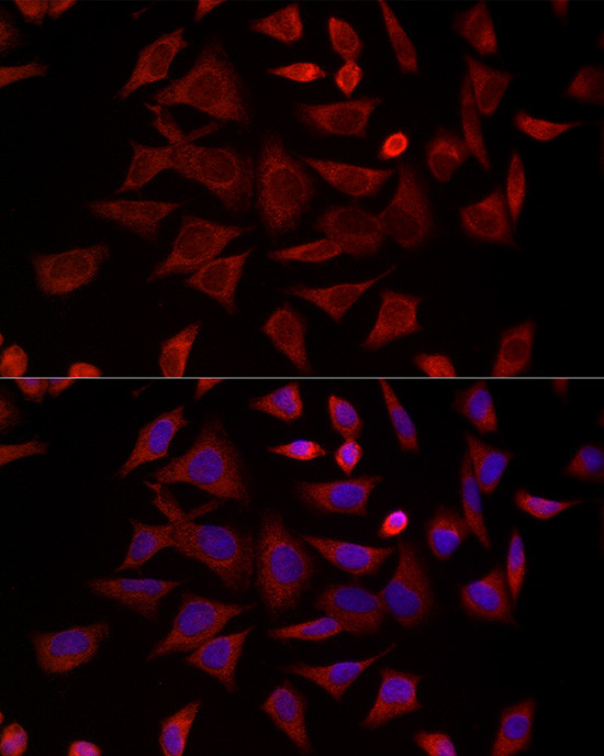 TCP-1 delta Antibody in Immunocytochemistry (ICC/IF)