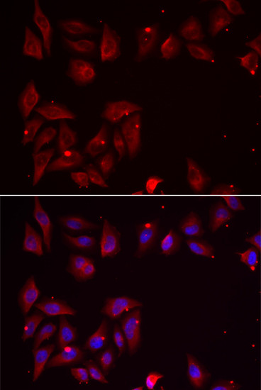 PDXK Antibody in Immunocytochemistry (ICC/IF)