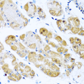 RPS2 Antibody in Immunohistochemistry (Paraffin) (IHC (P))