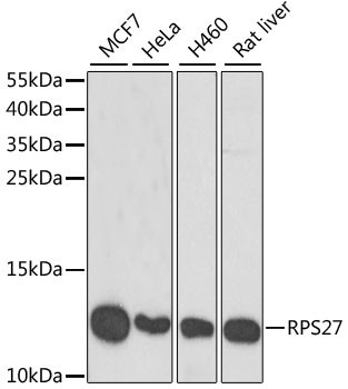 MPS1 Antibody in Western Blot (WB)