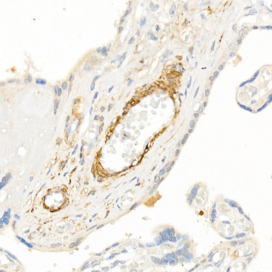 TAGLN Antibody in Immunohistochemistry (Paraffin) (IHC (P))