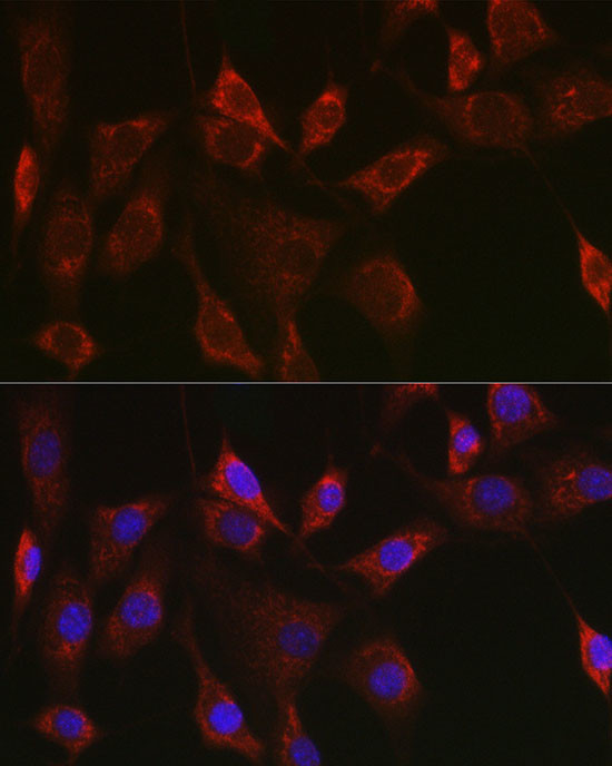 Thioredoxin 2 Antibody in Immunocytochemistry (ICC/IF)