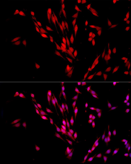 XPO5 Antibody in Immunocytochemistry (ICC/IF)