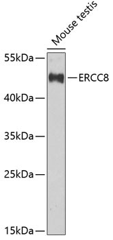 ERCC8 Antibody in Western Blot (WB)