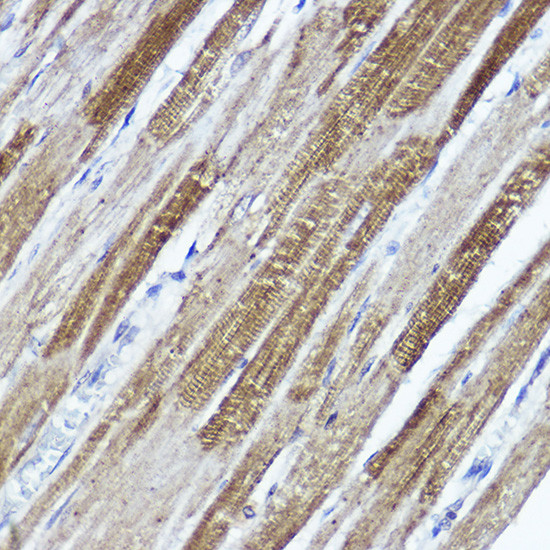 KV4.3 (KCND3) Antibody in Immunohistochemistry (Paraffin) (IHC (P))