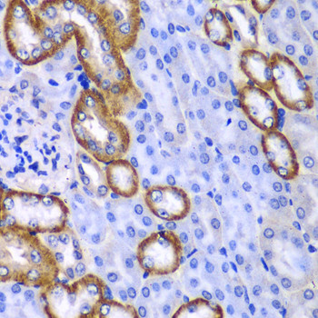 MYO1C Antibody in Immunohistochemistry (Paraffin) (IHC (P))