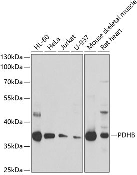 PDHB Antibody in Western Blot (WB)