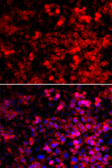 QARS Antibody in Immunocytochemistry (ICC/IF)